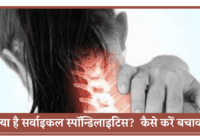 cervical pain - know the symptoms and treatment